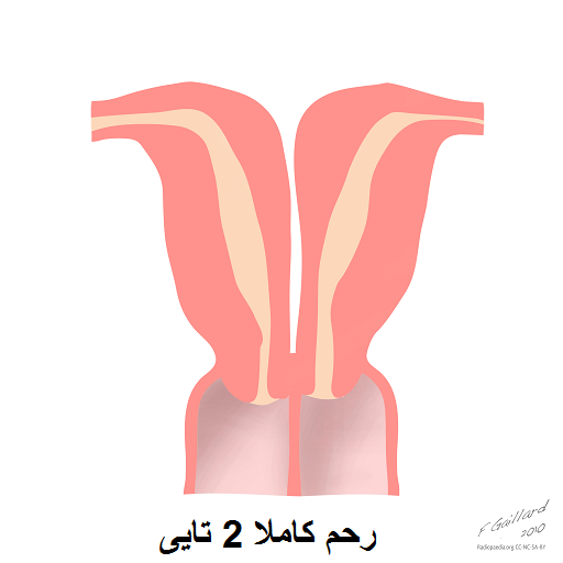رحم دوشاخ