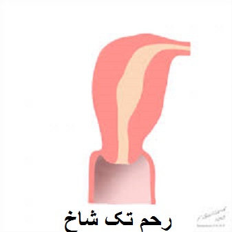 رحم تک شاخ