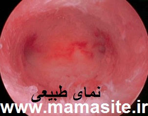 نمای طبیعی حرفه رحم