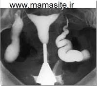 image-32
