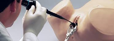 هیستروسکوپی نوعی اقدام جراحی است