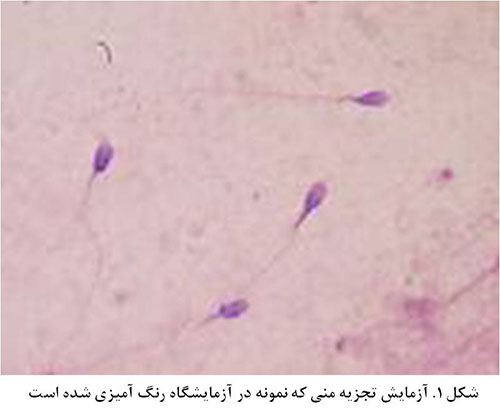 آزمایش اسپرم ، اسپرموگرام ، تحرک اسپرم