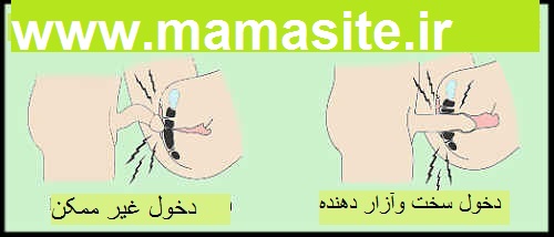 نزدیکی -  واژینیسموس و نزدیکی دردناک