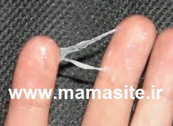 ترشحات طبیعی واژن