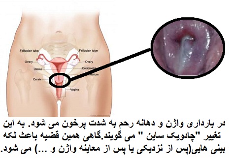 تغییرات دهانه رحم (سرویکس) در بارداری