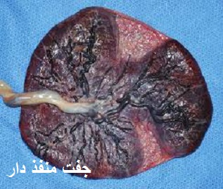 جفت منفذدار