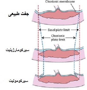 جفت اکستراکوریال
