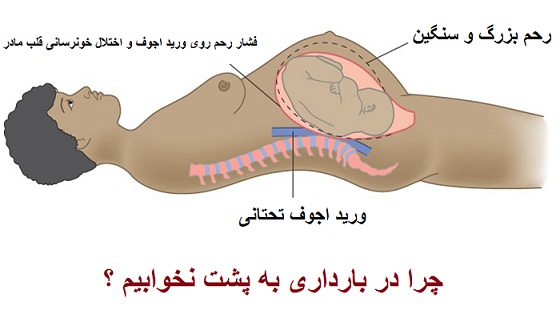 آیا خوابیدن به پشت در بارداری باعث پیچیدن بندناف یا خفگی جنین می شود