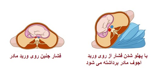طاق باز خوابیدن در بارداری - خوابیدن به پهلو در بارداری