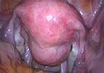 image-41